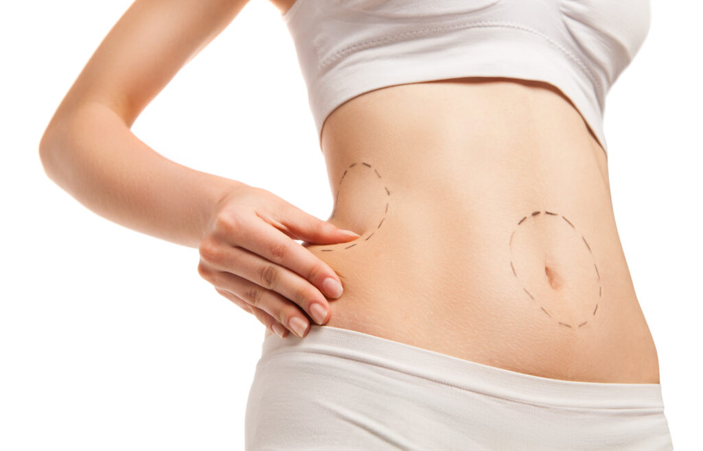 Patient with outlines on body in close-up